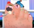 Nail Surgery Foot Spa